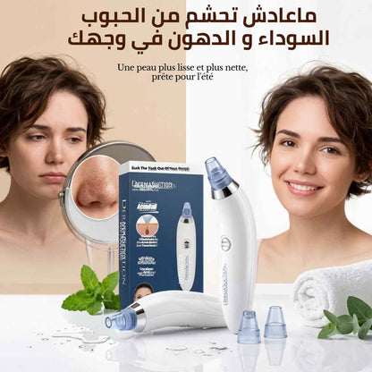 Aspirateur de points noirs- Dermasuction